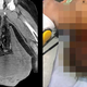 Imagen para el artículo titulado Escrotos insólitos o erecciones de 9 días: los casos que entraron a forma parte de la literatura médica en 2019